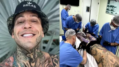 Igor Kannário se submete a anestesia geral para sessão de tatuagem no corpo todo - Foto: Reprodução/Redes sociais